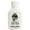 Acne Lotion - Essence de Beauté